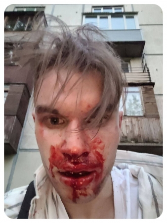 В Санкт-Петербурге напали на журналиста Петра Иванова