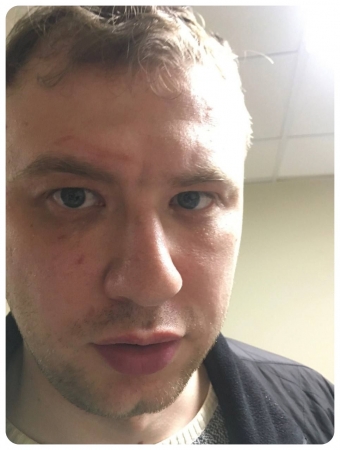 Артемий Бобров избит полицейскими
